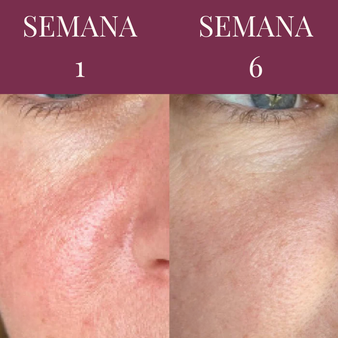 SÉRUM MALBEC - Image 4