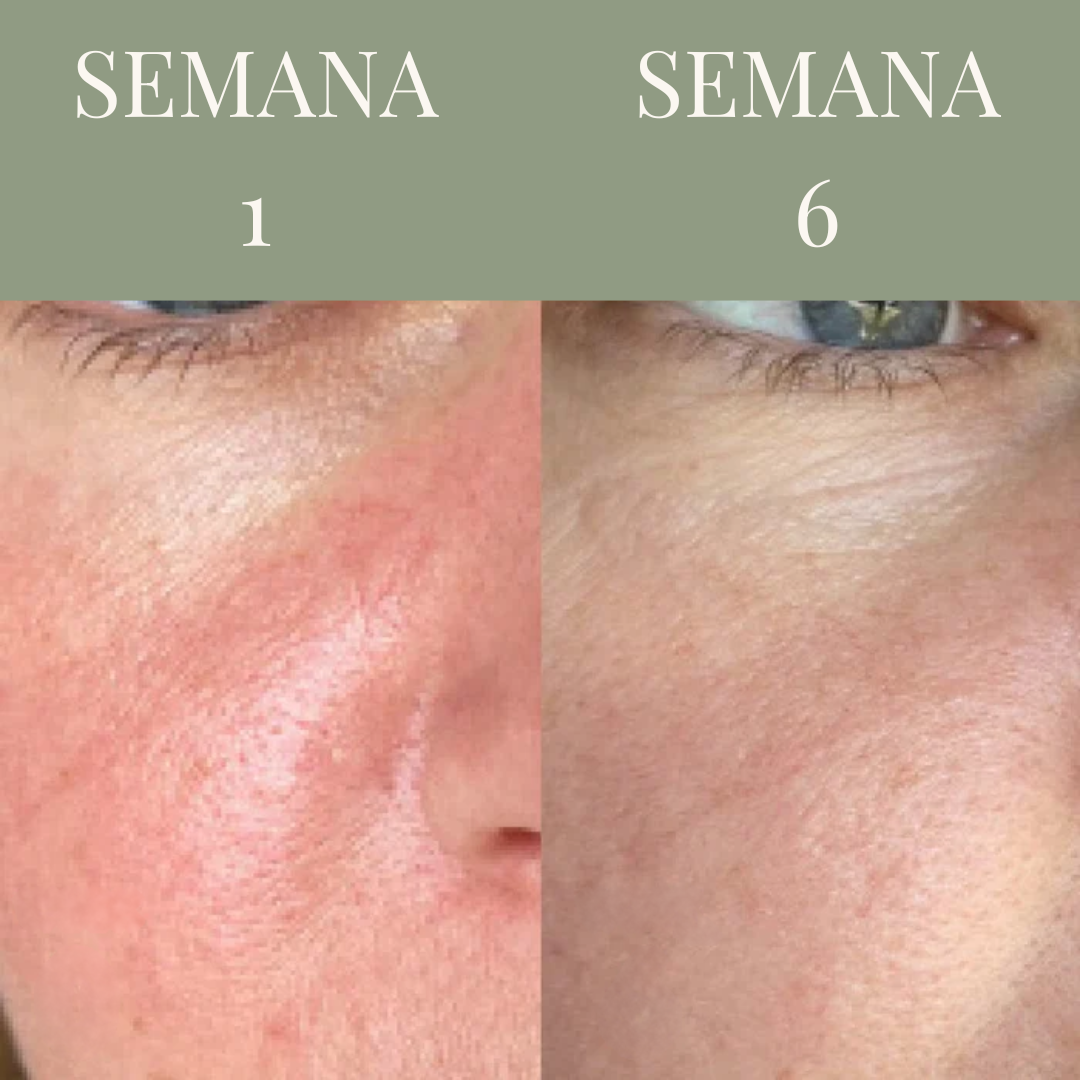 SÉRUM DE OLIVO - Image 4